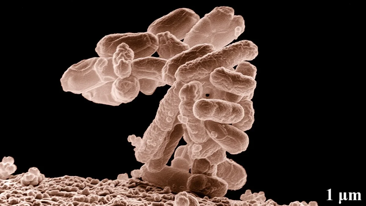 AI Berhasil Ciptakan Virus Biologis untuk Menginfeksi Bakteri E Coli