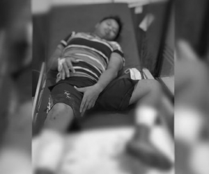 Irwanto alias Riski, begal sadis ditangkap di Banyuwangi menjalani perawatan setelah ditembak di kaki oleh polisi lantaran melawan. (ditreskrimum polda kalsel)