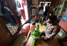Kondisi Terkini Bocah di Kotim Setelah Kakinya Sempat Digigit Buaya