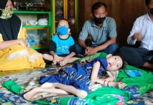 Senyum Bocah Lumpuh Otak Saat Melihat Rahmadian Noor