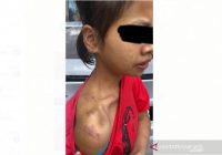 Polisi Malaysia Tangkap Dua Orang Penyiksa PRT WNI ﻿