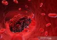 Italia Laporkan Empat Warganya Alami Pembekuan Darah Langka Lalu Meninggal Dunia Usai Diberi Vaksin AstraZeneca