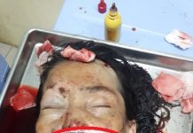 Seorang Wanita Tewas Setelah Kecelakaan Dekat Q Mall Banjarbaru