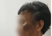 PLRT Indonesia Disiksa Majikan di Malaysia, Dua Tahun Bekerja Gaji Hanya Dibayar Tiga Kali
