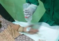 Marah Dapat Perlawanan, Perampok di Sampit Sabet Lengan Korban dengan Senjata Tajam