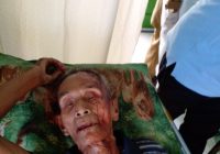 Seorang Pria Alami Kecelakaan, dirawat di Puskesmas Anjir Muara