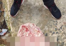 Berikut Hasil Visum Mayat Bayi yang ditemukan di Simpang Empat Tanah Bumbu