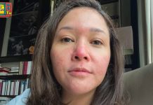 Pengakuan Maia Estianty Idap Penyakit Rosacea yang Sulit Disembuhkan