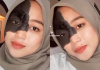 Kisah Ika Masriana Remaja Asal Sulawesi Barat Viral dan Sering Dirundung karena Miliki Tompel Unik di Wajah