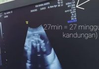 Beredar Hasil USG Lesti, Usia Kandungan 27 Minggu Diperkirakan Melahirkan Desember