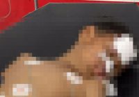 Korban Tabrak Lari di Asam-asam, Anak Usia 8 Tahun Meninggal Dunia