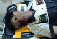Pria Tergeletak di Sungai Sipai, Korban Laka Tunggal Dilarikan ke IGD RS Ratu Zalecha