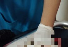 Seorang Korban Laka Tunggal di Pasir Mas Meninggal Dunia