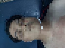 Perkelahian Berdarah Malam Tahun Baru di Kelayan, Korban Meninggal Dunia Akibat Luka Tusuk