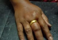 Cincin Tak Bisa Lepas Hingga Bikin Jari Bengkak, IRT di Liang Anggang Minta Bantuan Damkar Banjarbaru
