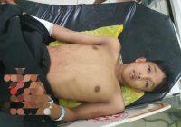 Diserang Orang Tak Dikenal, Yoga Alami 3 Mata Luka di Tubuhnya