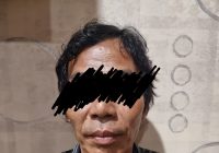Suami Tempelkan Rokok Menyala ke Pipi Istri Siri, Gara-garanya Ini