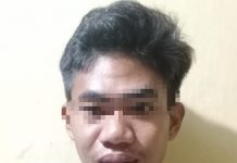 SADIS.. Siram Air Keras ke Wajah Mantan Istri di Pandawan, Berikut Modusnya