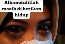 Mata Menghitam Diduga Korban Kerusuhan Stadion Kanjuruhan Malang