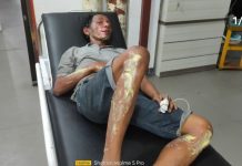 Jeriken Meledak, Tubuh Warga Petuk Katimpun Palangkaraya Terbakar