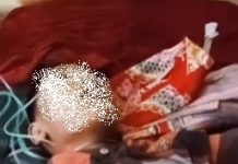 Miris, Siswa SD Dikeroyok Kakak Kelas Hingga Alami Koma, Videonya Viral