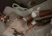 Viral Turis Australia Dibegal dan Dianiaya Brutal di Kuta, Polisi Bali Ungkap Fakta Ini