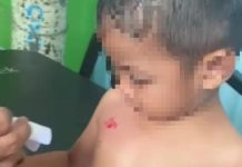 Warga Tapin Geger, Balita Hingga IRT Digigit Anjing Liar