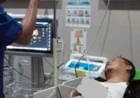 2 Jari Tangan Wakil Bupati Kaur Diamputasi, Gegara Hancur Kena Ledakan Petasan di Malam Tahun Baru