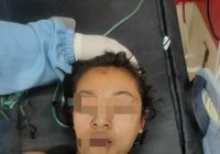 Wanita Muda Tanpa Identitas Tak Sadarkan Diri Setelah Lakalantas di Depan Citra Garden, Diduga Warga Pekapuran