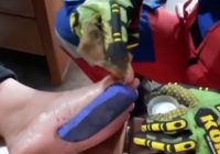Sandal Tak Bisa Lepas dari Kaki Seorang Anak Akibat Lem Korea, Klinik Serahkan ke Damkar