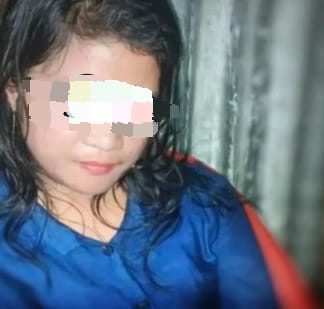 Pria yang Dipotong Alat Kelamin Oleh Selingkuhan Jalani Operasi Penyambungan, Begini Kondisinya