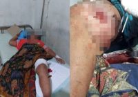 Pasutri Lansia Diserang Beruang Saat Sadap Karet di Upau Tabalong