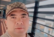 Demi Kesehatan, Saipul Jamil Rela Lidah dan Hidungnya Diisap Lintah Hingga Berdarah Bikin Netizen Ngeri, ini Manfaatnya