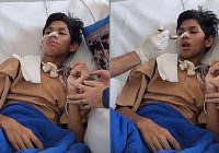 D Korban Mario Dandy Divonis Tak Bisa Sekolah Lagi Akibat Alami Diffuse Axonal Injury
