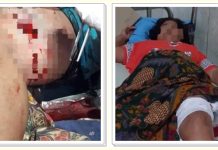 Kronologi Suami Istri Penyadap Karet di Upau Tabalong Diserang Beruang! Luka Parah di Paha