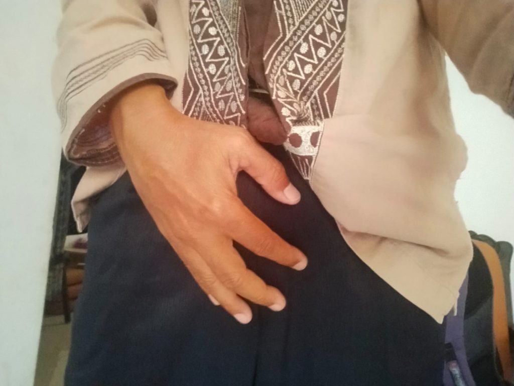 memotong bulu kemaluan
