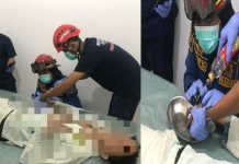 Pasien Pasang 17 Cincin di Jari, UGD Sambang Lihum Terpaksa Minta Bantuan Damkar