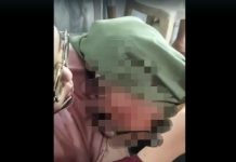 VIRAL! Remaja Putri Dipukul Helm di Jalan HKSN Hingga Trauma, Pelaku Diduga Perempuan