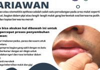 Apa Itu Panas Dalam? Ini 8 Buah yang Bisa Membantu Meredakannya