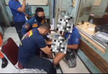 Cincin Tersangkut di Penis Hingga Bengkak, Pria ini Hubungi Damkar
