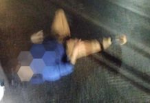 Kondisi Korban Tabrak Plat Besi Jembatan Pejagungan Bati Bati
