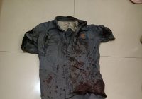 Akibat Menangkis Serangan Lawannya di Pasar Sudan Raya, Samsir Alami Sejumlah Luka