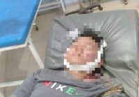Diduga Laka Tunggal di Banjarbaru, Pria Tanpa Identitas ini Meregang Nyawa, ini Ciri Fisiknya