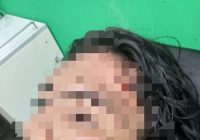 Polsek Sungai Loban Buru Sekelompok Orang Keroyok Dedi Hingga Tak Sadarkan Diri, Zainudin Turut Jadi Sasaran