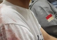 Dugaan Begal di Cempaka Sari Banjarmasin Barat Ramai Dibicarakan Warganet, Korban Alami Luka Tusuk
