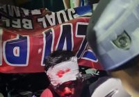 Laka Beruntun di Depan Pasar Batuah Banjarmasin, 1 Korban Luka Parah