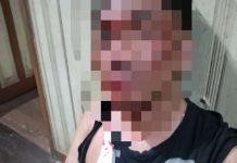 Tabrak Lari di Gatot Subroto : Kasat Lantas Ungkap Pengemudi Innova KH 1017 AR Pengaruh Amfetamin, Diduga Status ASN Inisial AM