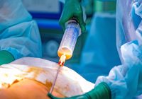 Kematian Selebgram Asal Medan di Klinik Sedot Lemak Depok, Polisi Tegaskan Bukan Delik Aduan