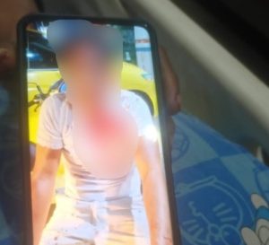Hadi Prayitno, sopir taksi online di Palangka Raya, Kalteng, yang menjadi korban penganiayaan penumpang. (wartabanjar.com - Ist. @infokalteng.reborn)