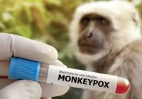 Cek Fakta Monkey Pox Bisa Diobati Antioksidan